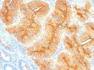 Immunohistochemistry-Paraffin: TAG-72 Antibody (B72.3) - IHC-Prediluted [NBP2-45173]