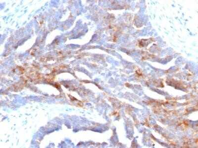 Immunohistochemistry-Paraffin: TAG-72 Antibody (B72.3) [NBP2-29412]