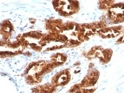 Immunohistochemistry-Paraffin: TAG-72 Antibody (B72.3) [NBP2-29412]