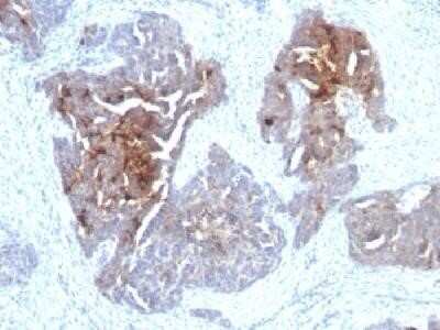 Immunohistochemistry-Paraffin: TAG-72 Antibody (CA72/733) - Azide and BSA Free [NBP2-34591]