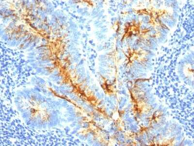 Immunohistochemistry-Paraffin: TAG-72 Antibody (CA72/733) - Azide and BSA Free [NBP2-34591]