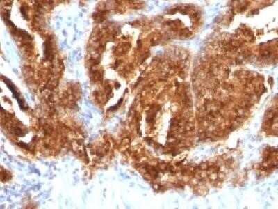 Immunohistochemistry-Paraffin: TAG-72 Antibody (CA72/733) - IHC-Prediluted [NBP2-45177]