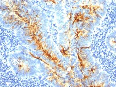 Immunohistochemistry-Paraffin: TAG-72 Antibody (CA72/733) [NBP2-32903]