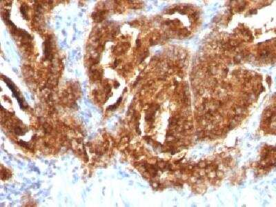 Immunohistochemistry-Paraffin: TAG-72 Antibody (CA72/733) [NBP2-32903]