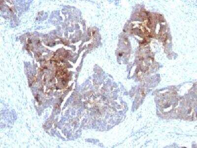 Immunohistochemistry-Paraffin: TAG-72 Antibody (CA72/733) [NBP2-32903]