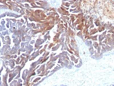 Immunohistochemistry-Paraffin: TAG-72 Antibody (CC49) - Azide and BSA Free [NBP2-33128]