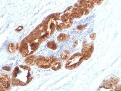 Immunohistochemistry-Paraffin: TAG-72 Antibody (CC49) - IHC-Prediluted [NBP2-45175]