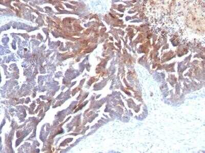 Immunohistochemistry-Paraffin: TAG-72 Antibody (CC49) [NBP2-31383]