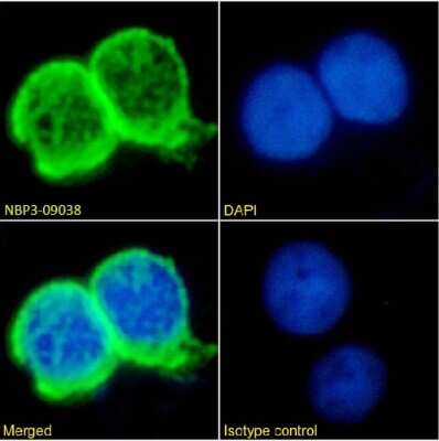 Immunocytochemistry/ Immunofluorescence: TAG-72 Antibody (Minretumomab (CC49)) - Chimeric - Azide and BSA Free [NBP3-09038]
