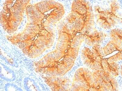 Immunohistochemistry-Paraffin: TAG-72 Antibody (SPM148) - Azide and BSA Free [NBP2-34741]