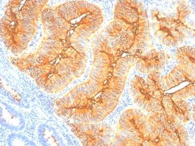 Immunohistochemistry-Paraffin: TAG-72 Antibody (SPM148) [NBP2-32995]