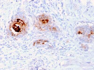 Immunohistochemistry-Paraffin: TAG-72 Antibody (rB72.3) - Azide and BSA Free [NBP3-08565]