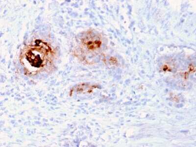 Immunohistochemistry-Paraffin: TAG-72 Antibody (rB72.3) [NBP3-07685]