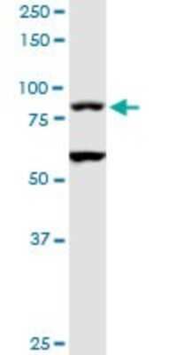 Western Blot: TAGAP Antibody [H00117289-D01P]