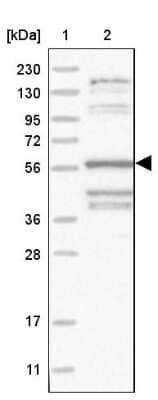 Western Blot: TAGAP Antibody [NBP1-88826]