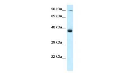 Western Blot: TAGAP Antibody [NBP2-88407]