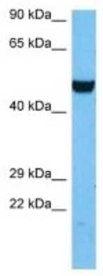 Western Blot: TAGAP Antibody [NBP3-10199]