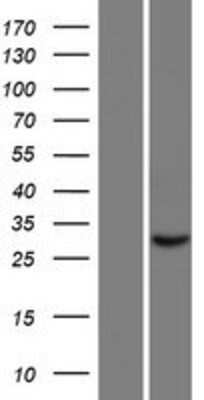 Western Blot: TAGAP Overexpression Lysate [NBP2-05626]