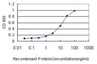 ELISA: TAK1 Antibody (2E10) [H00006885-M02]