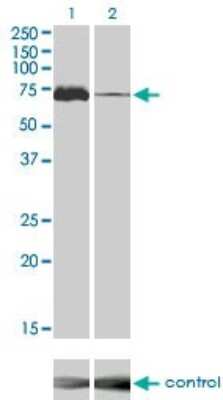 Western Blot: TAK1 Antibody (2E10) [H00006885-M02]