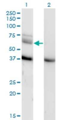 Western Blot: TAK1 Antibody (3C9) [H00006885-M04]