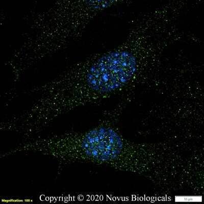 Immunocytochemistry/ Immunofluorescence: TAK1 Antibody [NB100-56363]