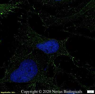 Immunocytochemistry/ Immunofluorescence: TAK1 Antibody [NB100-56363]