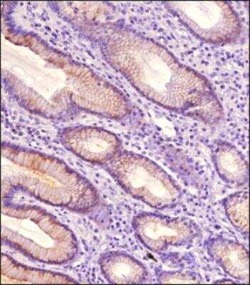 Immunohistochemistry-Paraffin: TAK1 Antibody [NB100-56363]