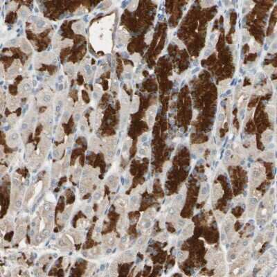 Immunohistochemistry-Paraffin: TAK1 Antibody [NBP1-87819]