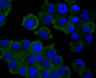 Immunocytochemistry/ Immunofluorescence: TAK1 Antibody (JM73-19) [NBP2-67180]