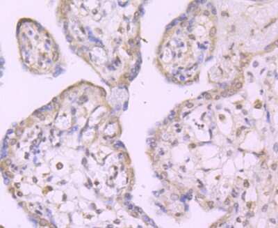Immunohistochemistry-Paraffin: TAK1 Antibody (JM73-19) [NBP2-67180]