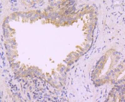Immunohistochemistry-Paraffin: TAK1 Antibody (JM73-19) [NBP2-67180]