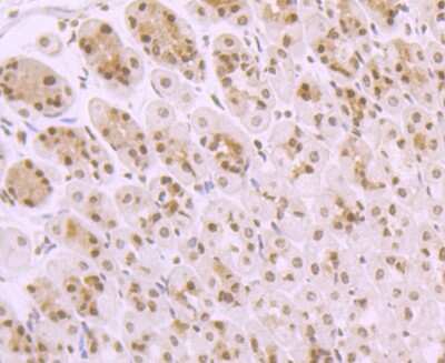 Immunohistochemistry-Paraffin: TAK1 Antibody (JM73-19) [NBP2-67180]
