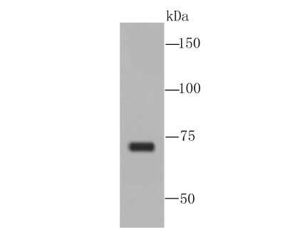 Western Blot: TAK1 Antibody (JM73-19) [NBP2-67180]