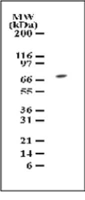 Western Blot: TAK1 Antibody [NB100-56363]