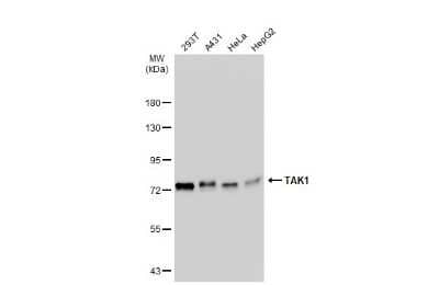 Western Blot: TAK1 Antibody [NBP3-13401]