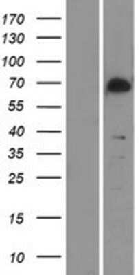 Western Blot: TAK1 Overexpression Lysate [NBP2-10876]