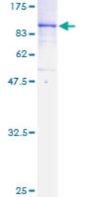 SDS-PAGE: Recombinant Human TAK1 GST (N-Term) Protein [H00006885-P01]