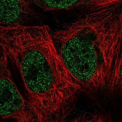 Immunocytochemistry/ Immunofluorescence: TAK1L Antibody [NBP2-56145]