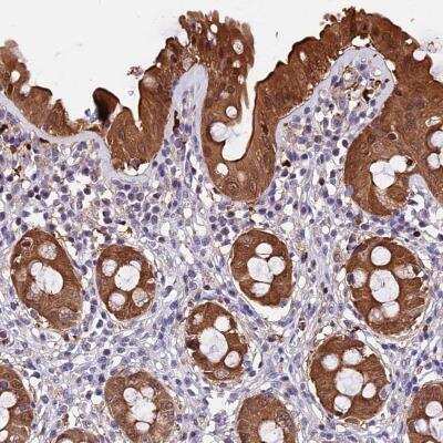 Immunohistochemistry: TAK1L Antibody [NBP1-81767]