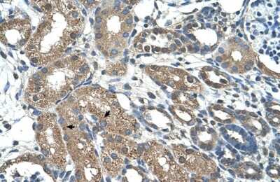 Immunohistochemistry-Paraffin: TAK1L Antibody [NBP1-56678]