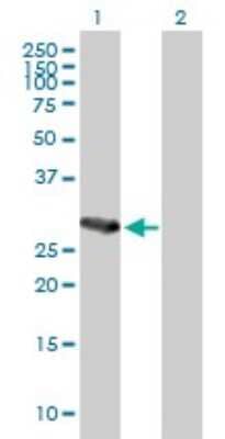 Western Blot: TAK1L Antibody [H00056911-B01P]