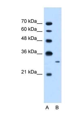 Western Blot: TAK1L Antibody [NBP1-56678]