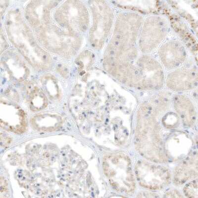 Immunohistochemistry-Paraffin: TAL2 Antibody [NBP1-88638]