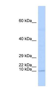 Western Blot: TAL2 Antibody [NBP1-80307]