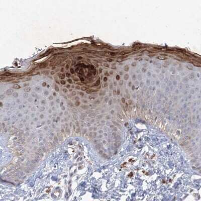 Immunohistochemistry-Paraffin: TANC1 Antibody [NBP1-82896]