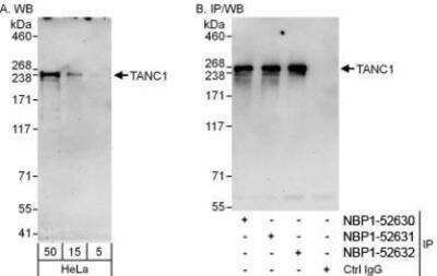 Western Blot: TANC1 Antibody [NBP1-52630]