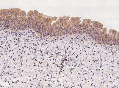 Immunohistochemistry-Paraffin: TANGO2 Antibody [NBP3-06602]