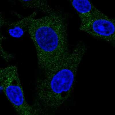 Immunocytochemistry/ Immunofluorescence: TANK Antibody [NBP2-38358]