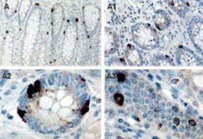 Immunohistochemistry: TANK Antibody [NB100-56144]